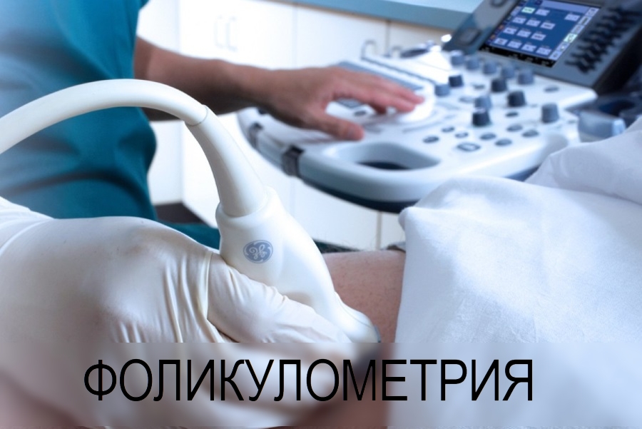 Фолликулометрия - современный Фолликулометрия -